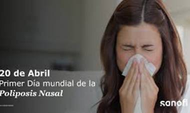 20 DE ABRIL: DIA MUNDIAL DE LA POLOPOSIS NASAL